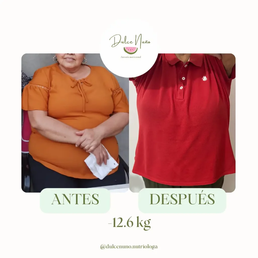Comparativa de persona mayor antes y después de bajar 12.6 kilogramos con seguimiento nutricional profesional