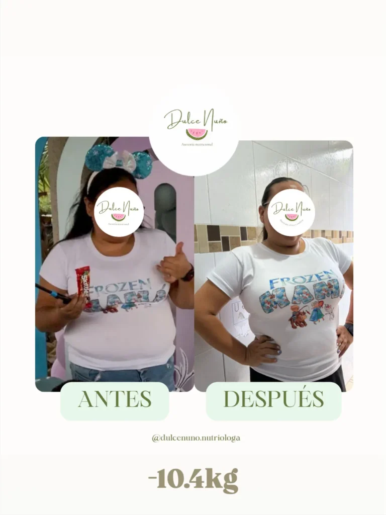 Comparativa de mujer antes y después de bajar 10.4 kilogramos con acompañamiento nutricional