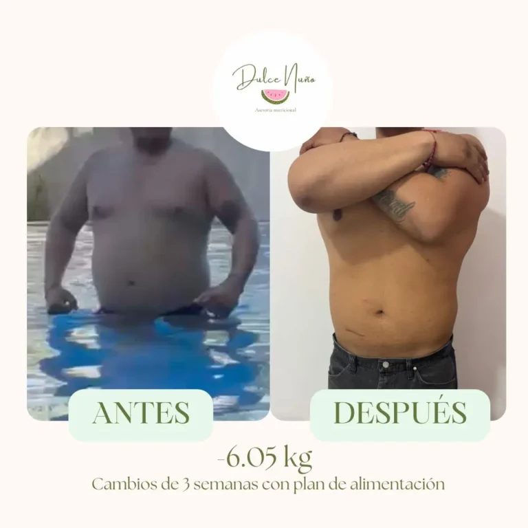 comparativa de antes y después de paciente masculino con una pérdida de 6.05 kg en 3 semanas siguiendo un plan de alimentación personalizado de la nutrióloga Dulce Nuño