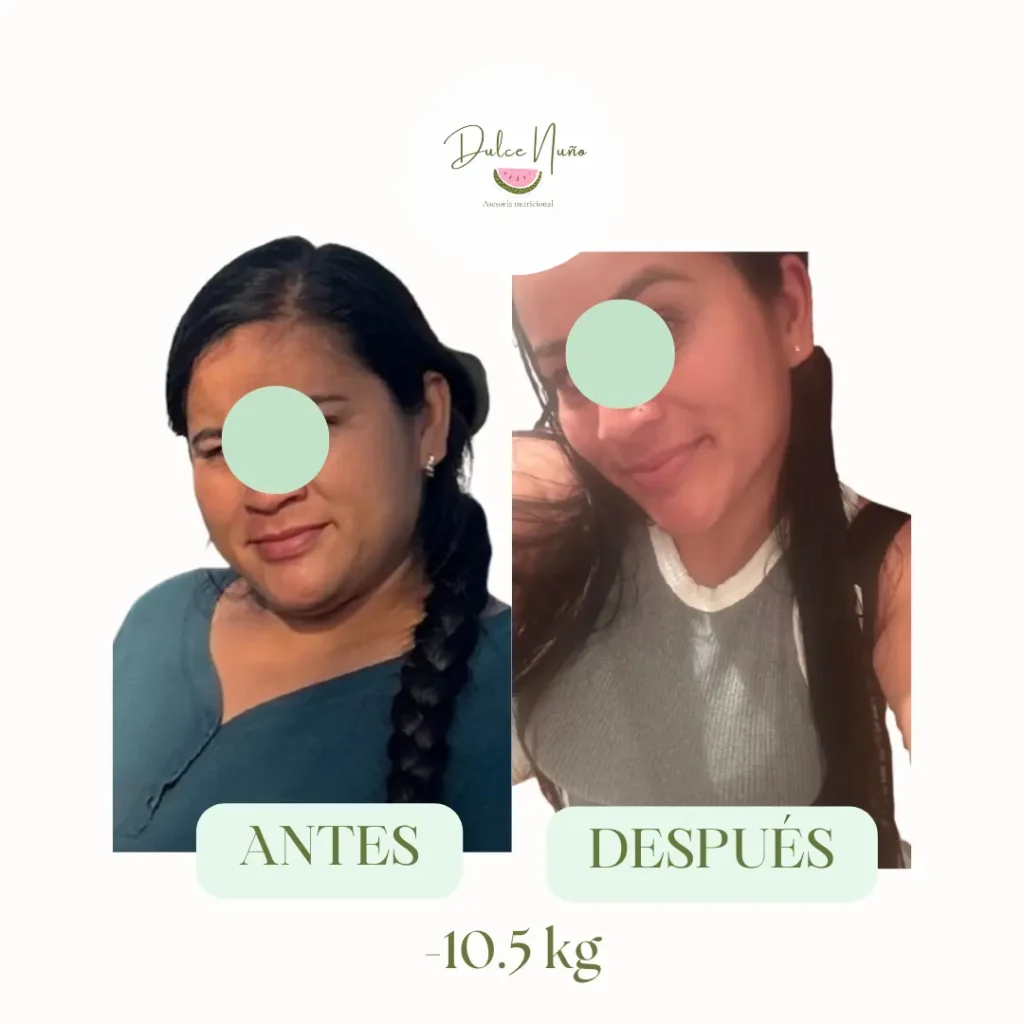 Mujer después de bajar 10.5 kilogramos con reducción visible de cachetes y cambios faciales