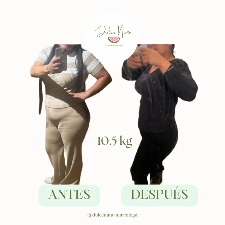 Comparativa de mujer antes y después de bajar 10.5 kilogramos con cambios físicos visibles